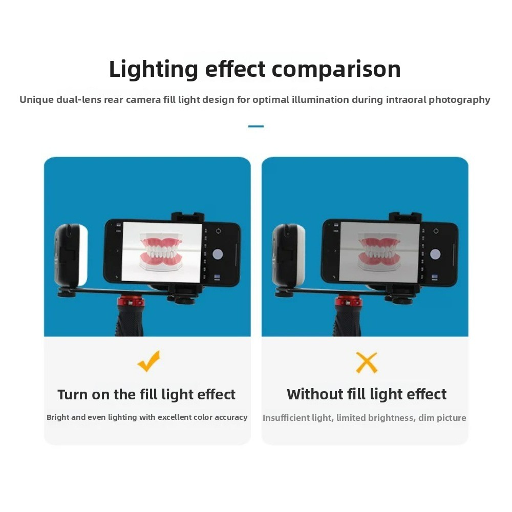 Dental Photography Light, Blue - Photography Lighting Portable review and price